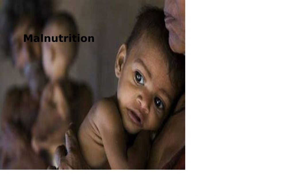 MALNUTRITION