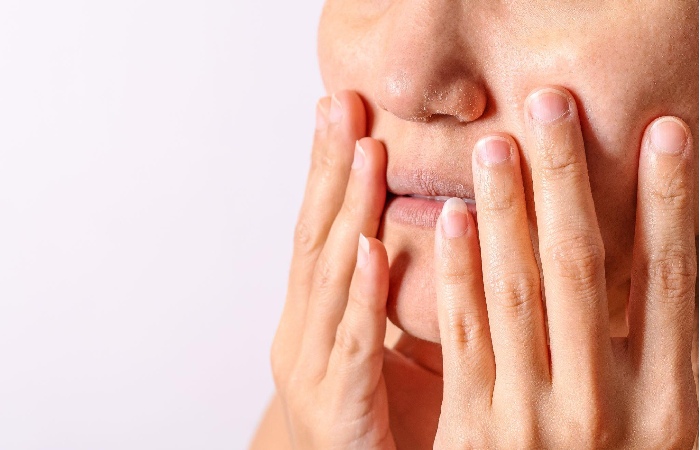 Skin Problems In Winter