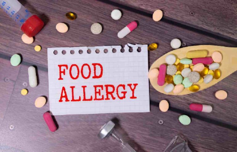 Food Allergy – Definition, Symptoms, Treatment and More