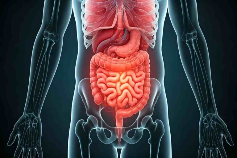 4 Stages of Appendicitis
